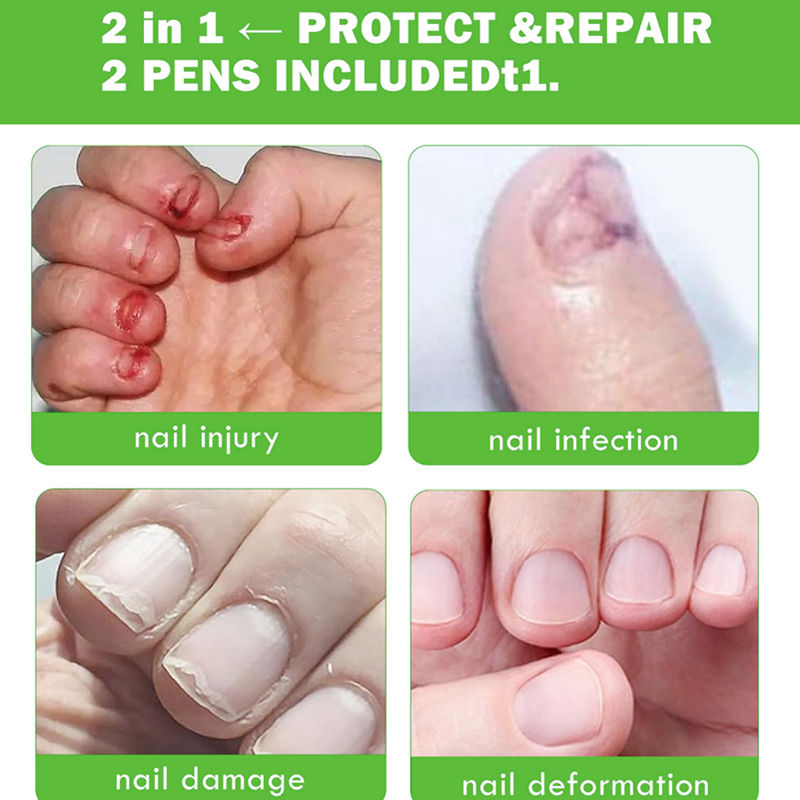 No-Bite Nail Care Solution 💅