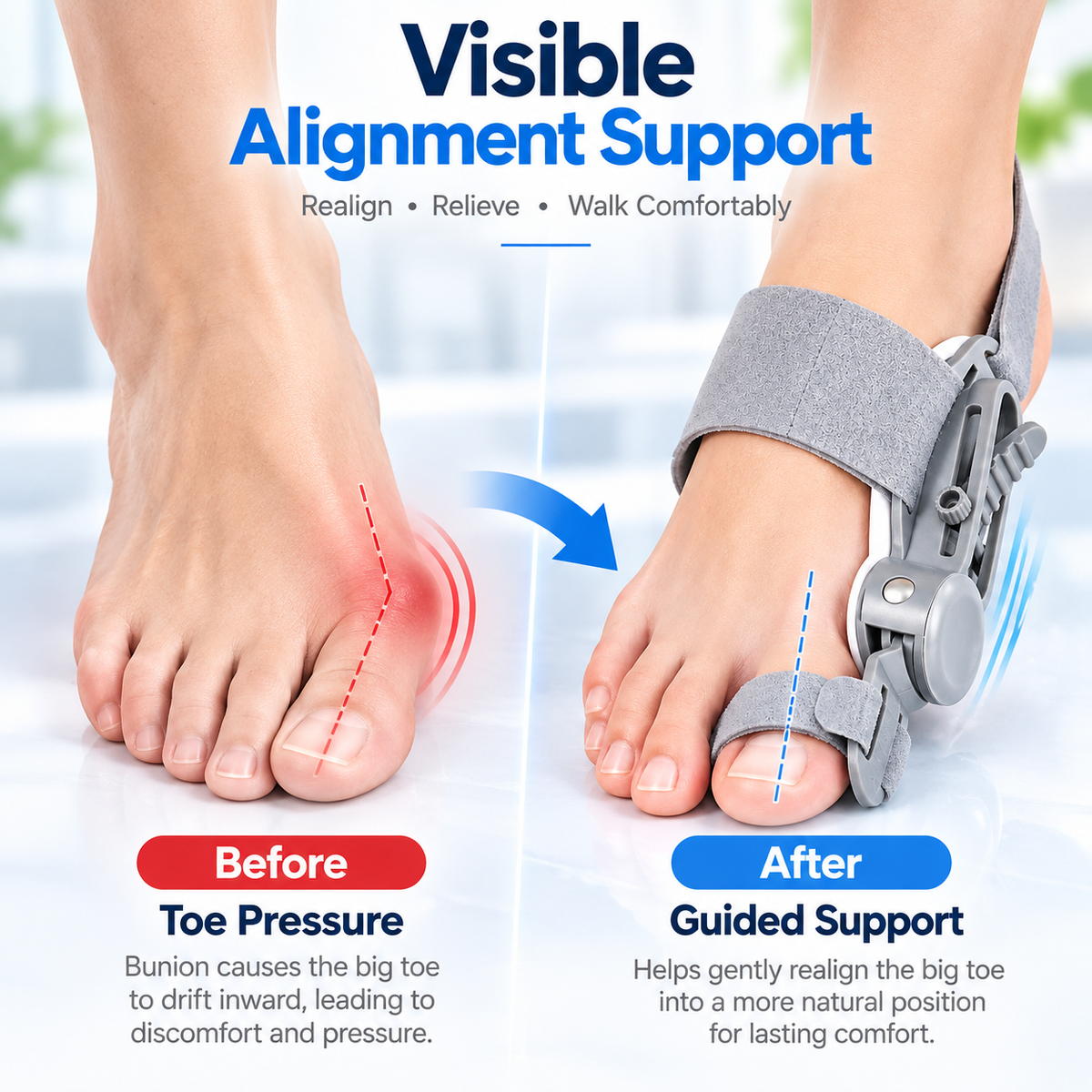 Toe Align Pro